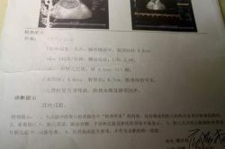 六次彩超均被告知发育正常 孕妇生下手足畸形儿