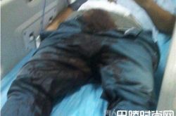 17岁男子挥刀自宫称“想做女人”