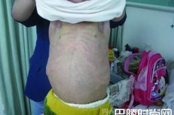 厄运缠身 女孩11岁的年龄80岁的外表