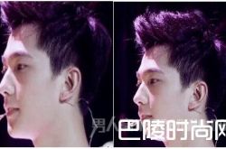 立秀膨体垫下巴：这效果我给100分！