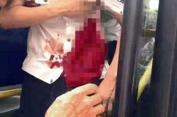 公交司机命悬一线 男子嫌喇叭太吵连捅司机3刀