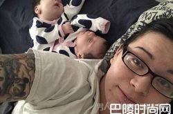 母爱的力量 女子坚持诞下连体双胞胎孩子十分健康