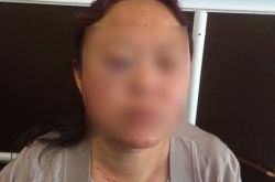 因停车起冲突连打两架 女司机挪车遭六人围殴