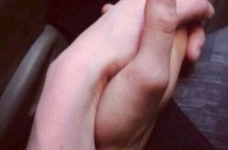 女子恋爱半年不敢和男友牵手 竟是手汗在作怪