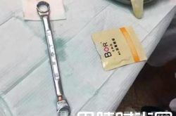 太尴尬！ 男子下体被扳手套住最后口腔医生来解围