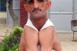 男子患病成橡皮人 身体随意翻折还能拿吉尼斯记录