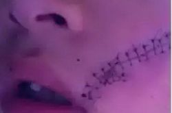 冰箱拿饮料爆炸脸部缝了38针 这样的错误你也一定犯过