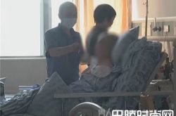 七旬老人食用秋葵食物中毒