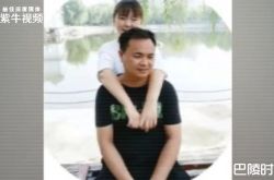 17岁女儿李辰玺全身80%烧伤 父李志锋割整条腿皮肤救女