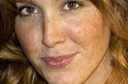 脸上长斑的原因,能够美白祛斑的食物