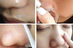 解说黑头导出液的原理以及好处,黑头导出液的使用方法