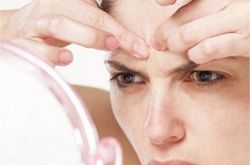 什么是黑头,如何去黑头