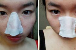 黑头导出液什么牌子好,黑头是怎样产生的