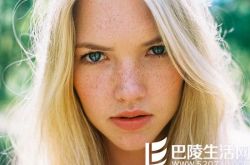 为什么会长雀斑,脸上长雀斑吃什么好