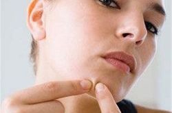 有逗必挤 低头玩手机过量甜食摄入没有彻底清洁皮肤睡眠不足没有及时补水不做防晒措施