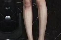 【图】王鸥的腿没PS长这样左小腿现离奇长疤 盘点明星未ps腿杨幂最丑