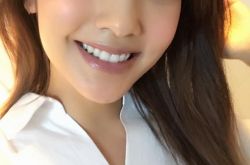 杨丞琳整过容吗 杨丞琳晒7年前后对比照