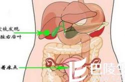 宝宝怀在肝脏上 吸血宝宝惊现人间?