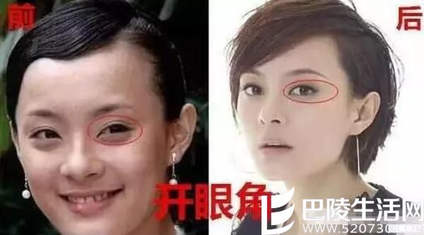 孙俪曾自爆整容 孙俪整容前后照片对比图