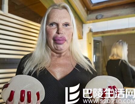 变性男子整形成瘾成老妪 美男子变成鸭子嘴 变性男子整形成瘾成老妪 美男子变成鸭子嘴