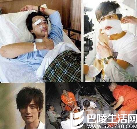 胡歌变身拳击打手 胡歌车祸前后照片对比及原因曝光 胡歌变身拳击打手 胡歌车祸前后照片对比及原因曝光