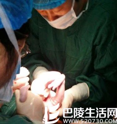 18岁孕妇诞连体双胞胎男婴 肝脏相连体重4.1kg