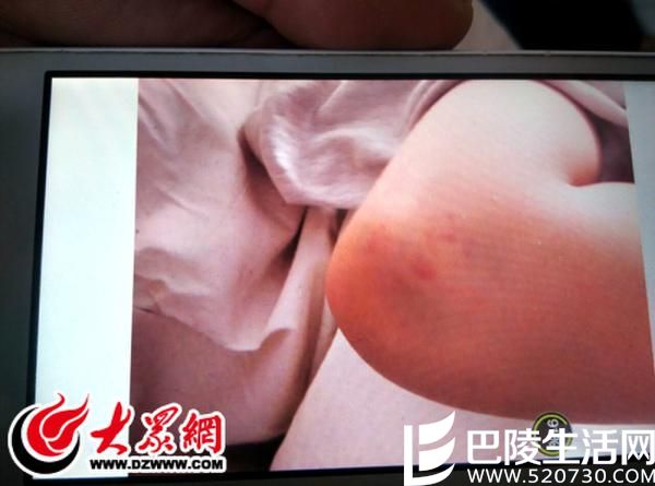 怀孕教师体罚学生 用棍子将孩子脑袋打伤 怀孕教师体罚学生 用棍子将孩子脑袋打伤