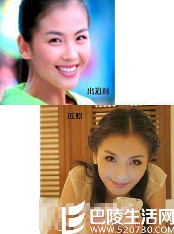 刘涛晒照穿透视装 刘涛整容前后照片对比