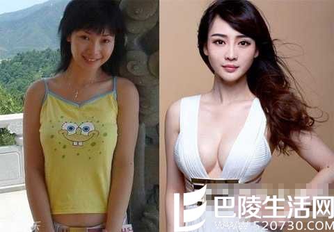 柳岩透视裙秀性感 柳岩整容前后对比照曝光