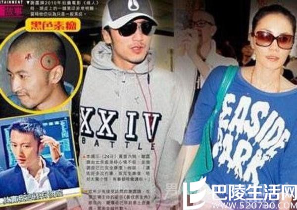 谢霆锋皮肤癌 谢霆锋皮肤癌