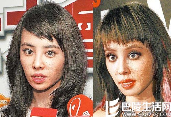 蔡依林严重冒痘 蔡依林严重冒痘