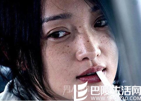 周迅“烂脸”不忍直视 周迅“烂脸”不忍直视