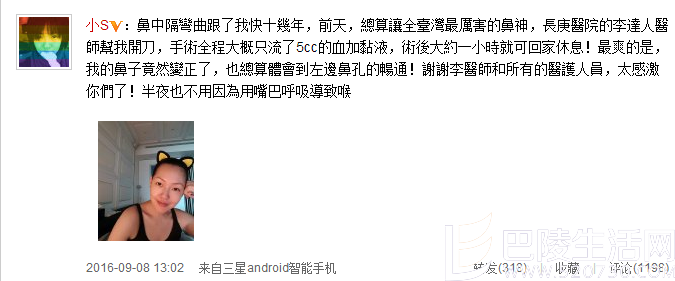 小S微博回应鼻子歪