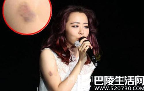 张靓颖演唱会摔下舞台 张靓颖演唱会摔下舞台