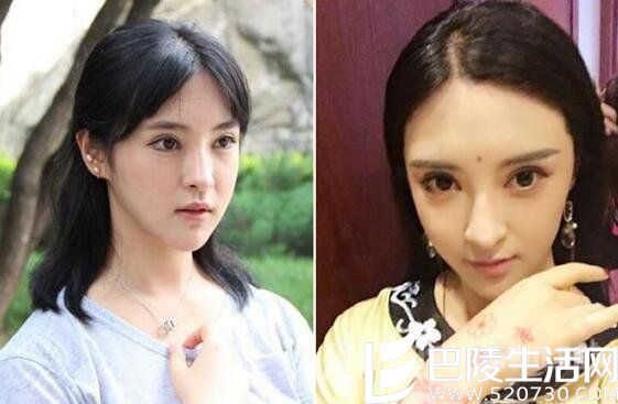 疑邢珊整容前后对比照