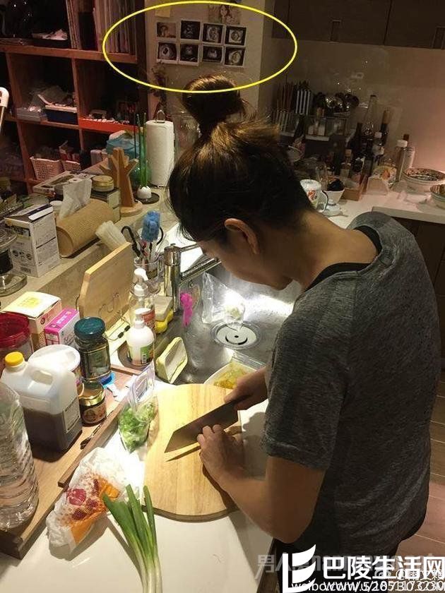 Ella超音波照曝光