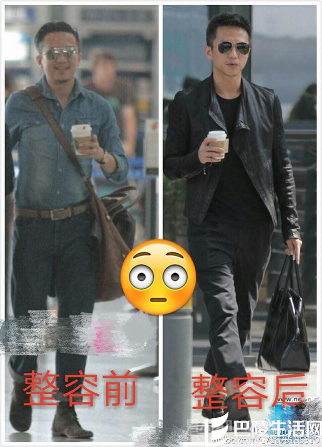 邓超“整容前后”照