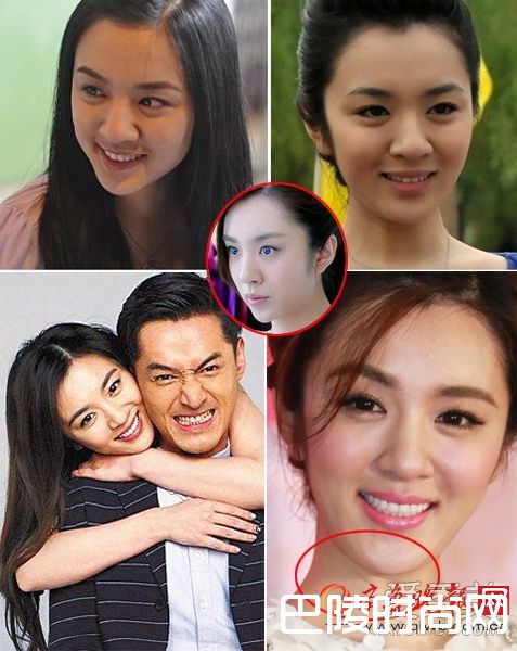 王晓晨整容照片