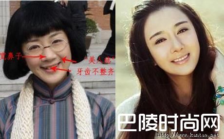 李依晓整容对比照