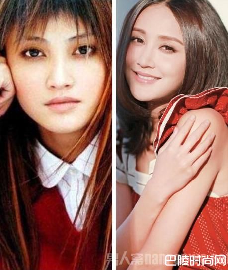 张歆艺整容对比照片