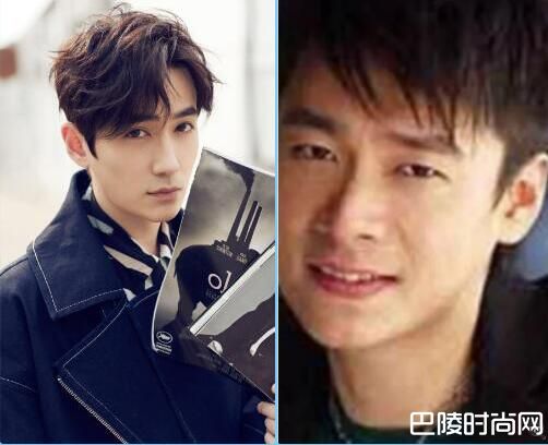 朱一龙整容对比照