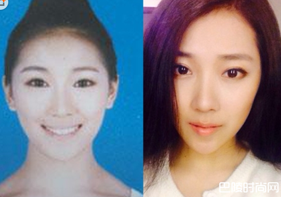 管韧姿整容对比照