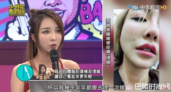 ▲雪碧整形。 (图/翻摄自YouTube)