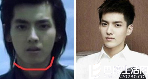 吴亦凡整容前后 吴亦凡整容前后