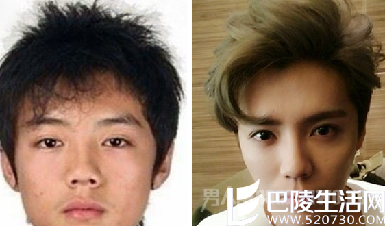鹿晗整容前后 鹿晗整容前后