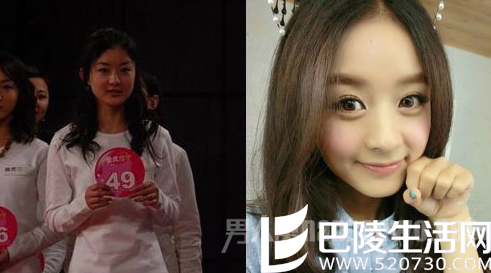 赵丽颖疑似整容
