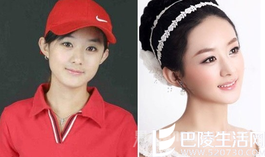 赵丽颖整容前后差距大