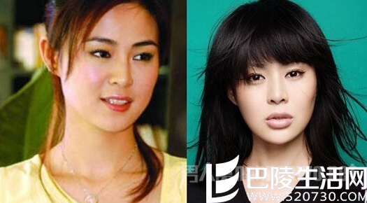 佟大为老婆整容前后对比 佟大为老婆整容前后对比