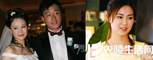 佟大为老婆整容前大圆脸,整容后瓜子脸 佟大为老婆整容前大圆脸,整容后瓜子脸