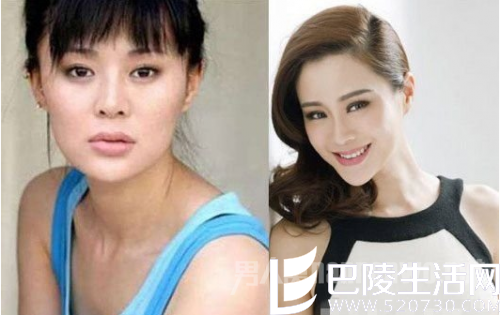 佟大为老婆整容前后脸型变化大 佟大为老婆整容前后脸型变化大